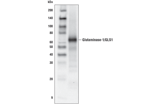 Western Blotting Image 1: Glutaminase-1/GLS1 Antibody