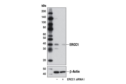  Image 1: SignalSilence® ERCC1 siRNA I