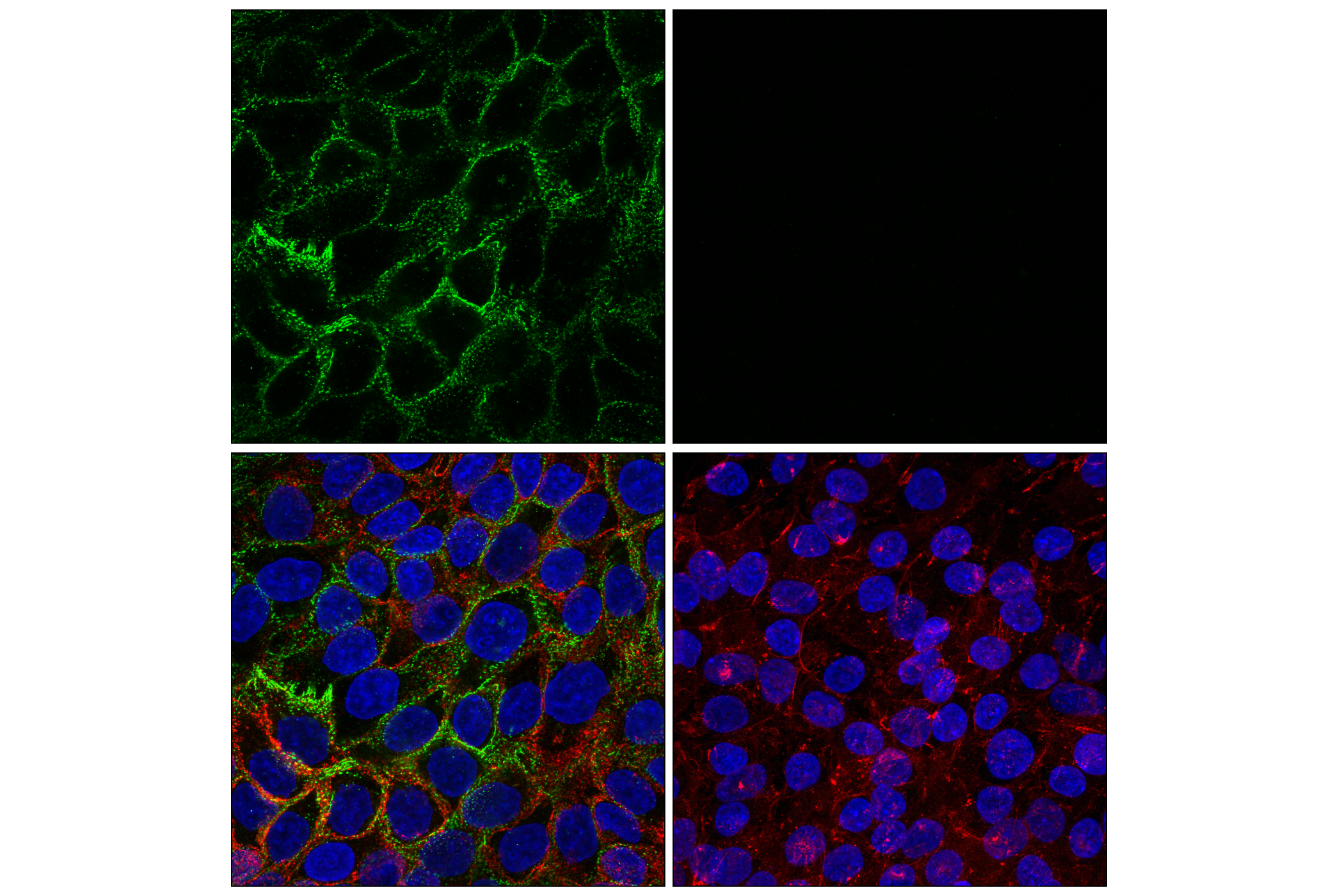 Immunofluorescence Image 1: Desmoglein 2 (8E5) Mouse mAb