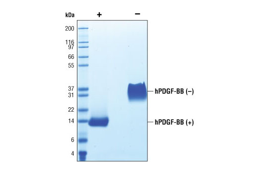 Image 2: Human Platelet-Derived Growth Factor BB (hPDGF-BB)