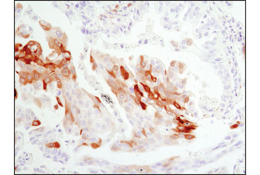 Immunohistochemistry Image 3: Phospho-NDRG1 (Thr346) (D98G11) XP® Rabbit mAb (BSA and Azide Free)