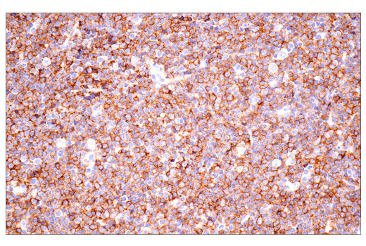 Immunohistochemistry Image 3: CD23 (E1R4G) Rabbit mAb (BSA and Azide Free)