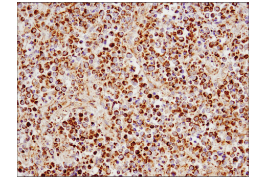Immunohistochemistry Image 2: SLP-2 (D2I9X) XP® Rabbit mAb
