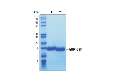  Image 2: Human Granulocyte Macrophage Colony Stimulating Factor (hGM-CSF)