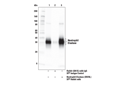 Immunoprecipitation Image 1: Neutrophil Elastase (E9C9L) XP® Rabbit mAb