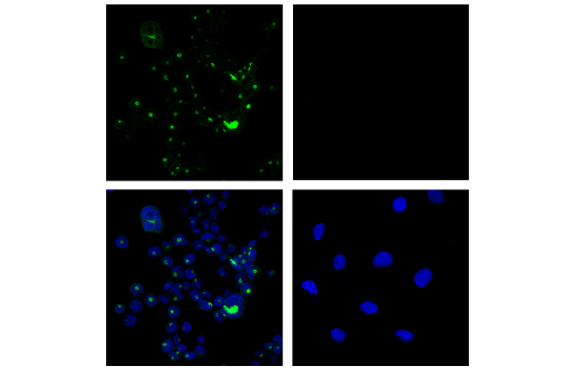 Immunofluorescence Image 1: Neutrophil Elastase (E9C9L) XP® Rabbit mAb