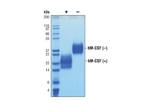  Image 2: Human CSF-1/M-CSF Recombinant Protein
