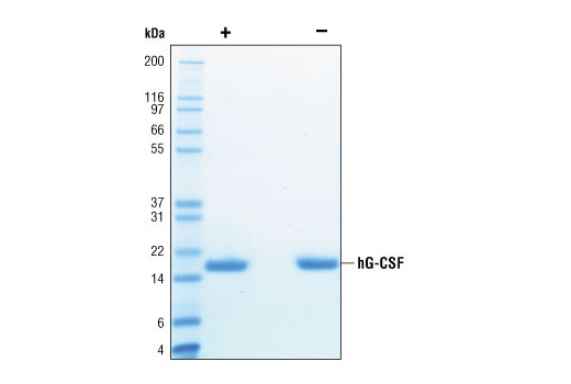  Image 2: Human Granulocyte Colony Stimulating Factor (hG-CSF)