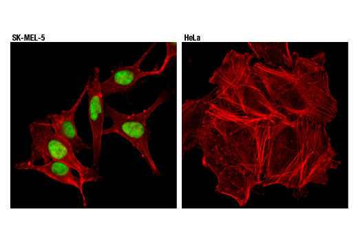 Immunofluorescence Image 1: Sox10 (D5V9L) Rabbit mAb