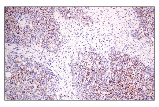 Immunohistochemistry Image 3: BCL6 (E5I8I) Rabbit mAb
