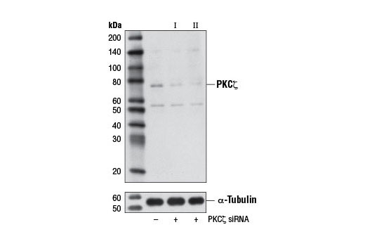  Image 1: SignalSilence® PKCζ siRNA II