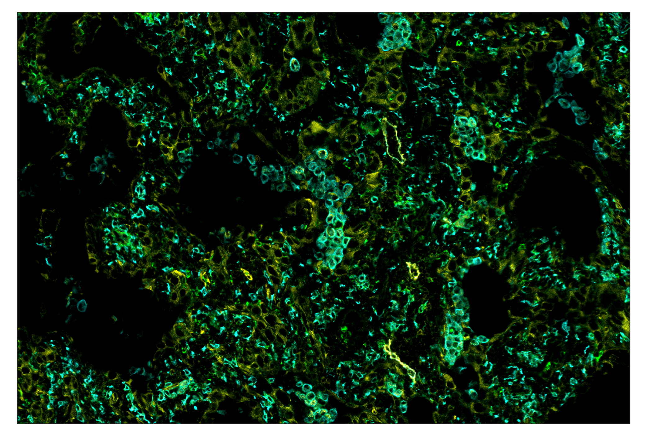 Immunohistochemistry Image 7: CD11b/ITGAM (D6X1N) & CO-0037-647 SignalStar™ Oligo-Antibody Pair