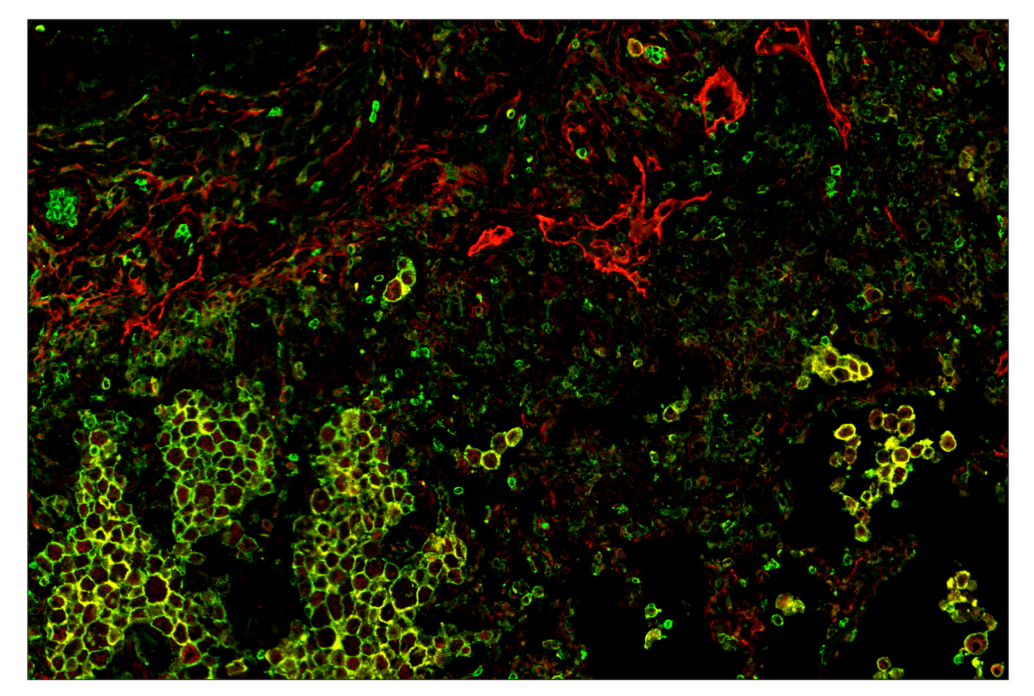 Immunohistochemistry Image 8: CD11b/ITGAM (D6X1N) & CO-0037-750 SignalStar™ Oligo-Antibody Pair