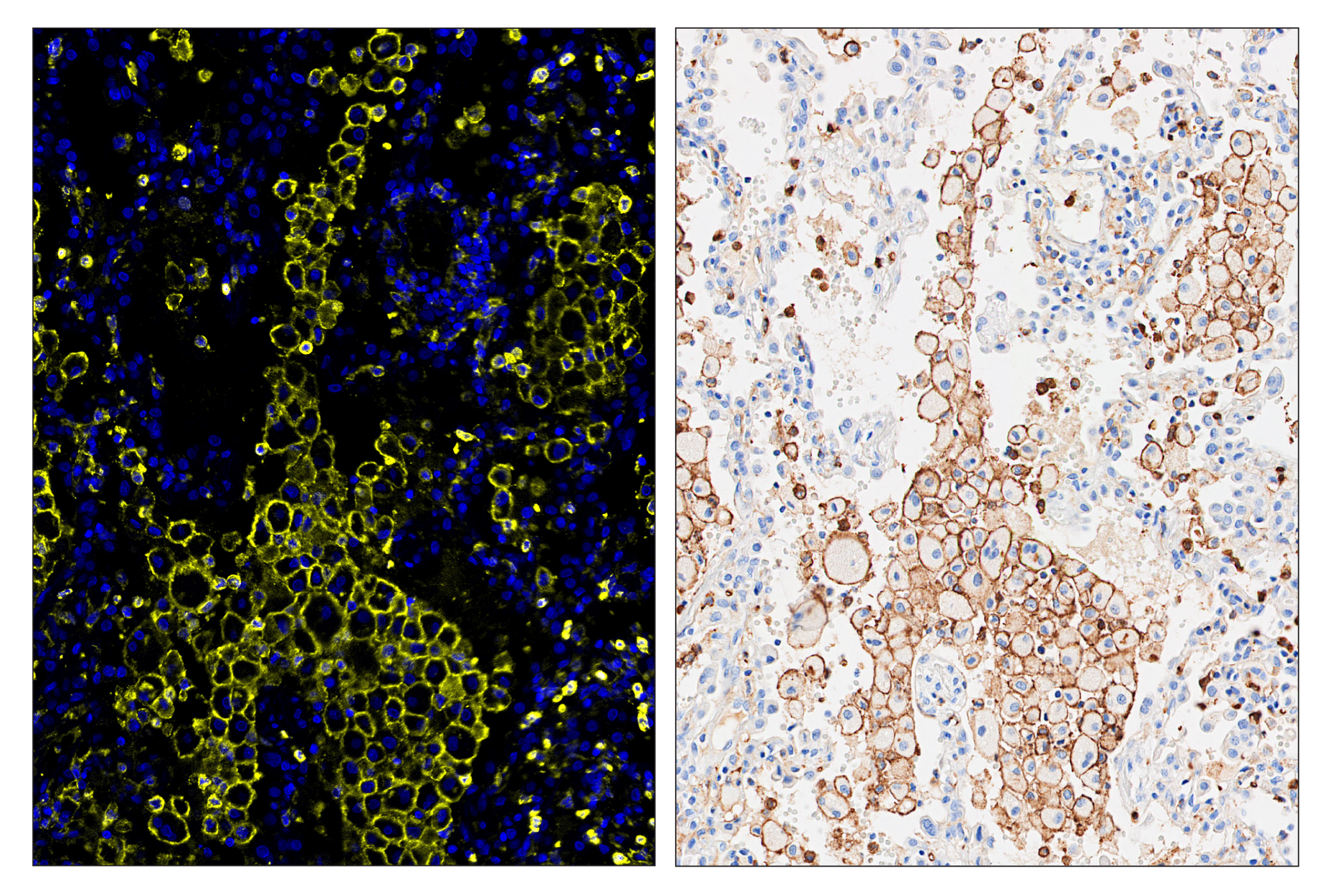 Immunohistochemistry Image 6: CD11b/ITGAM (D6X1N) & CO-0037-750 SignalStar™ Oligo-Antibody Pair