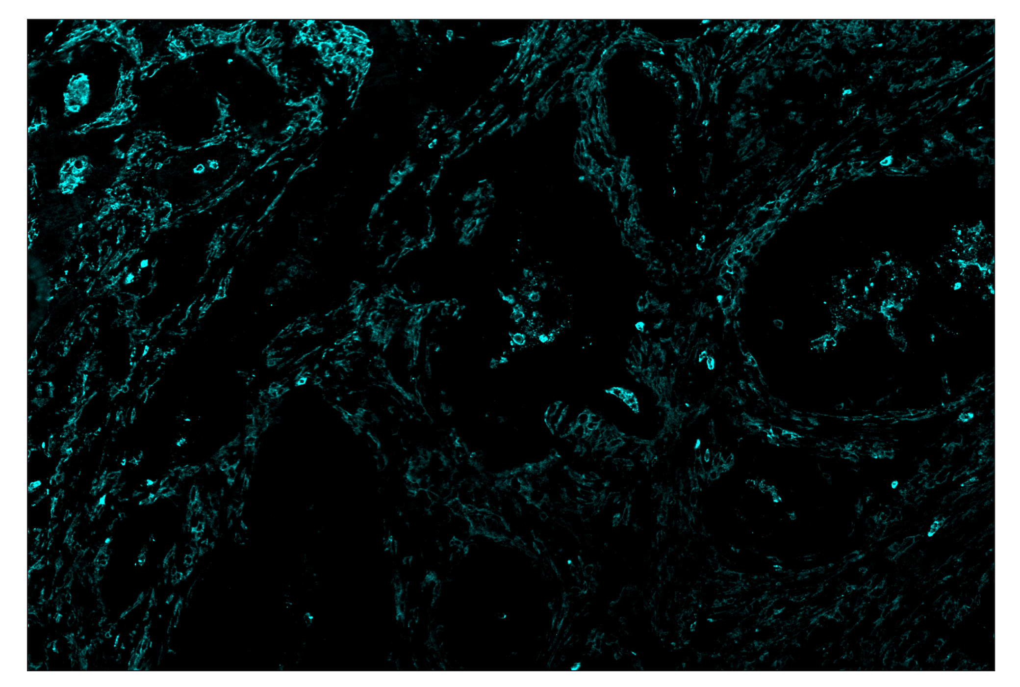 Immunohistochemistry Image 5: CD11b/ITGAM (D6X1N) & CO-0037-488 SignalStar™ Oligo-Antibody Pair