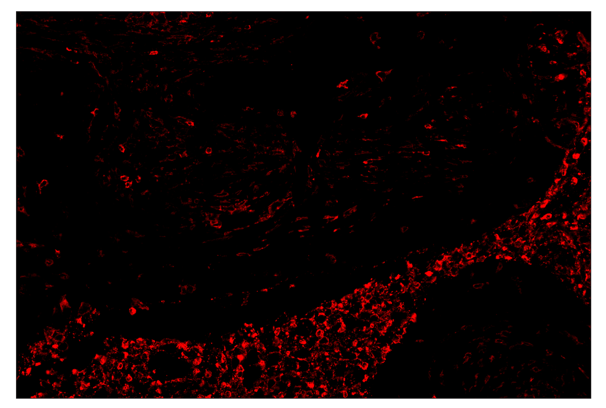 Immunohistochemistry Image 4: CD11b/ITGAM (D6X1N) & CO-0037-647 SignalStar™ Oligo-Antibody Pair