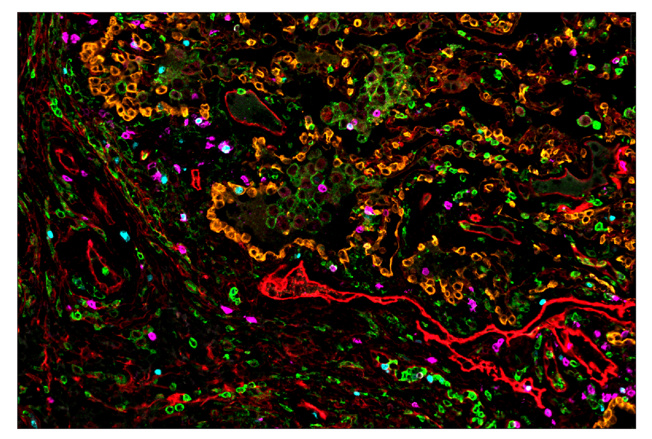 Immunohistochemistry Image 1: CD11b/ITGAM (D6X1N) & CO-0037-750 SignalStar™ Oligo-Antibody Pair