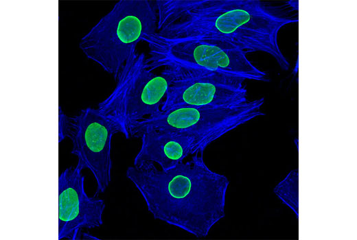 Immunofluorescence Image 2: Alexa Fluor® 647 Phalloidin