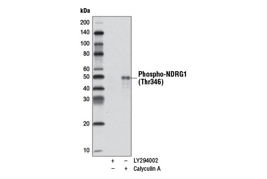 Western Blotting Image 1: Phospho-NDRG1 (Thr346) (D98G11) XP® Rabbit mAb (HRP Conjugate)