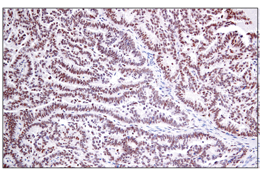 Immunohistochemistry Image 2: RAI17/ZMIZ1 (E2X3X) Rabbit mAb