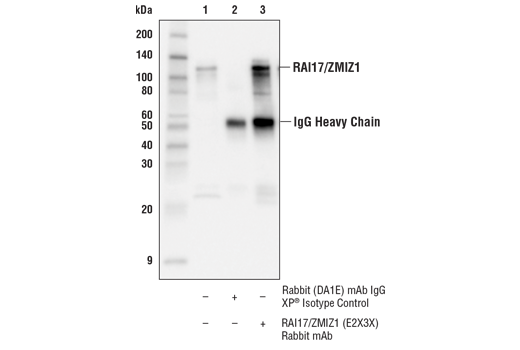 Immunoprecipitation Image 1: RAI17/ZMIZ1 (E2X3X) Rabbit mAb