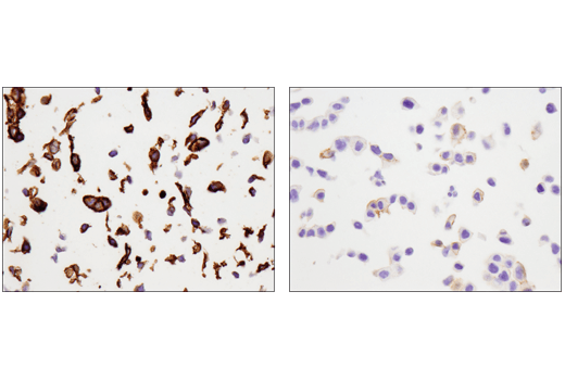 Immunohistochemistry Image 5: Tissue Factor/CD142 (E9M6T) XP® Rabbit mAb (BSA and Azide Free)