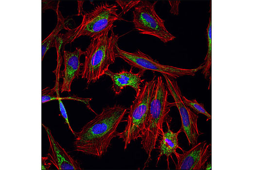 Immunofluorescence Image 2: Alexa Fluor® 555 Phalloidin