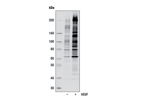  Image 9: Receptor Tyrosine Kinase Antibody Sampler Kit