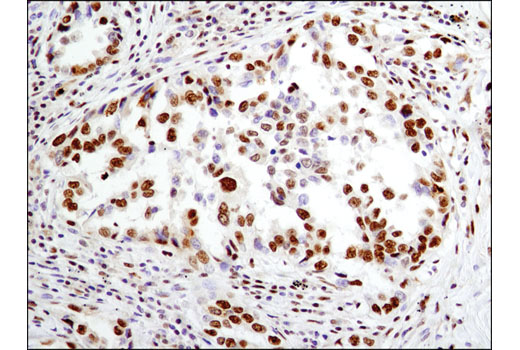 Immunohistochemistry Image 2: IFI16 (D8B5T) Rabbit mAb (BSA and Azide Free)