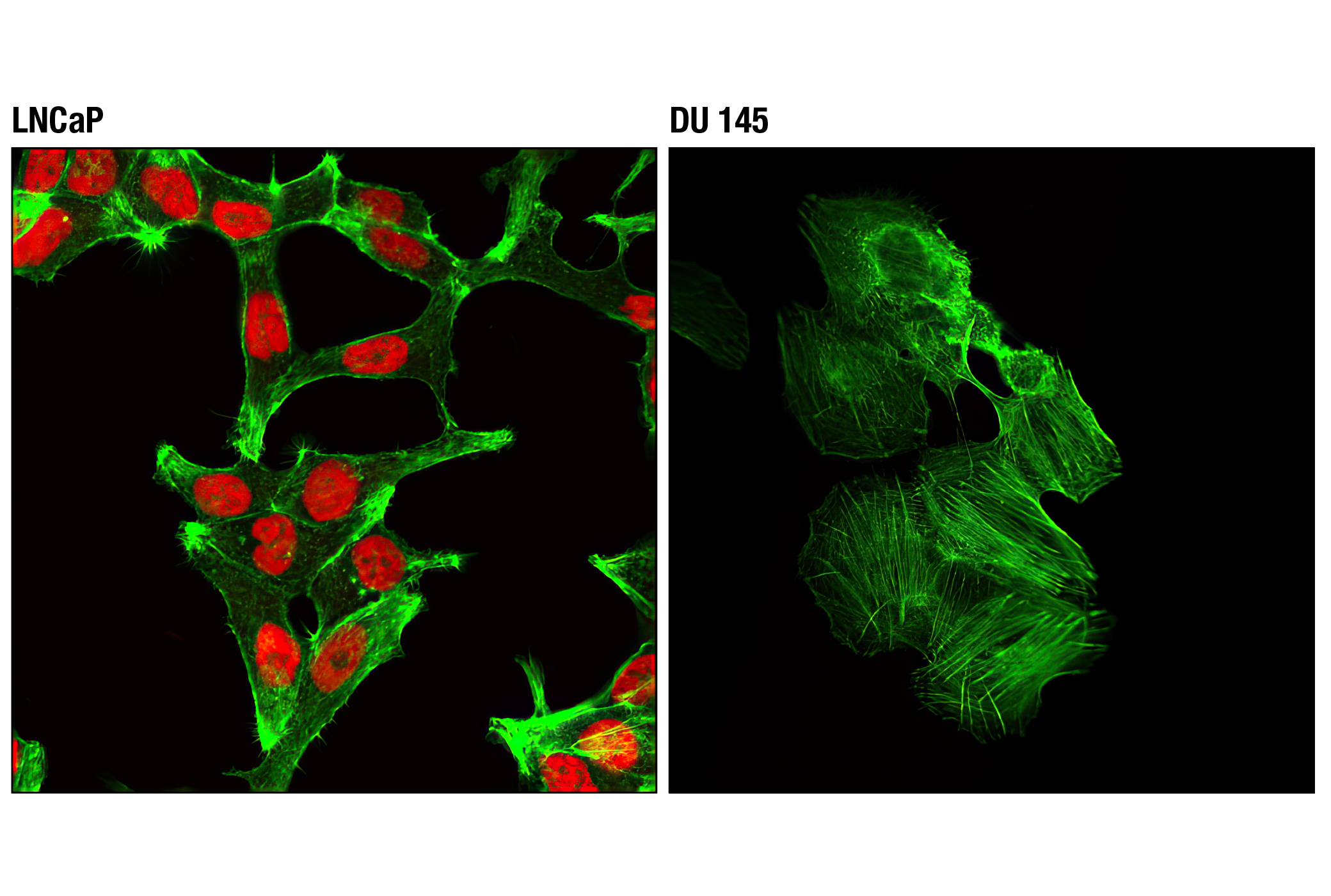 Immunofluorescence Image 1: Androgen Receptor (D6F11) XP® Rabbit mAb (Alexa Fluor® 555 Conjugate)
