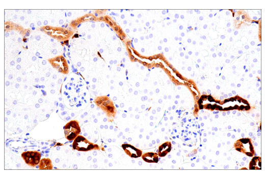 Immunohistochemistry Image 6: Galectin-3/LGALS3 (E7B6R) Rabbit mAb