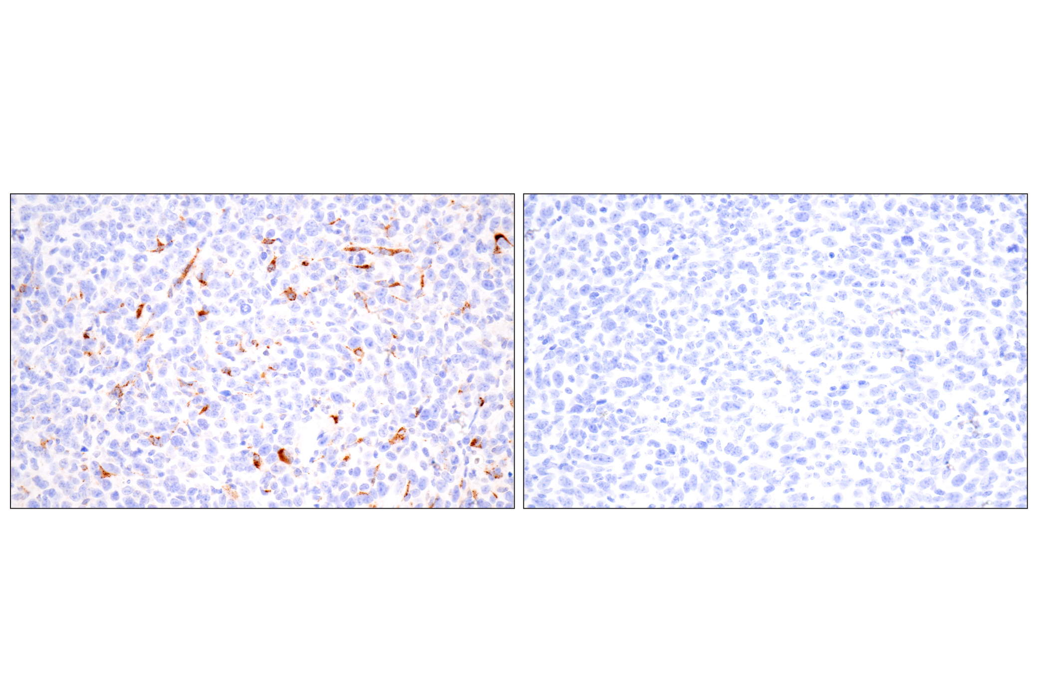 Immunohistochemistry Image 7: Cathepsin K (E7U5N) Rabbit mAb (BSA and Azide Free)