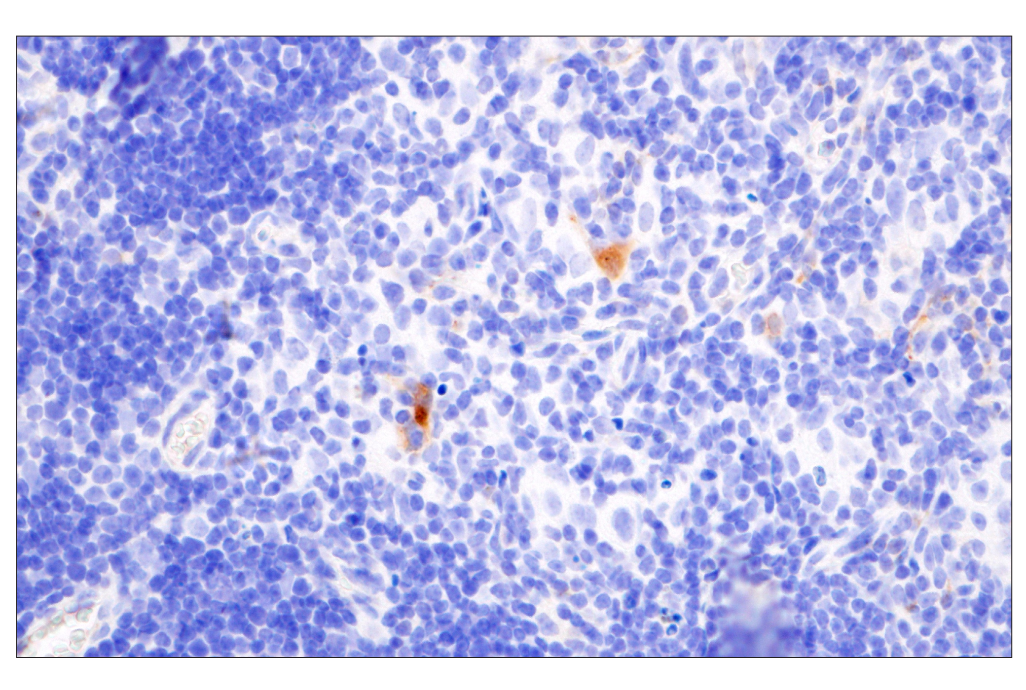 Immunohistochemistry Image 5: Cathepsin K (E7U5N) Rabbit mAb (BSA and Azide Free)
