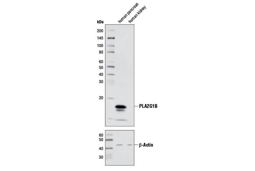 Western Blotting Image 1: PLA2G1B Antibody