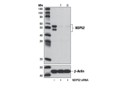  Image 1: SignalSilence® NDP52 siRNA I