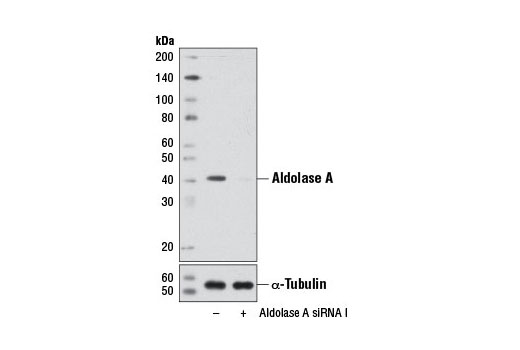  Image 1: SignalSilence® Aldolase A siRNA I