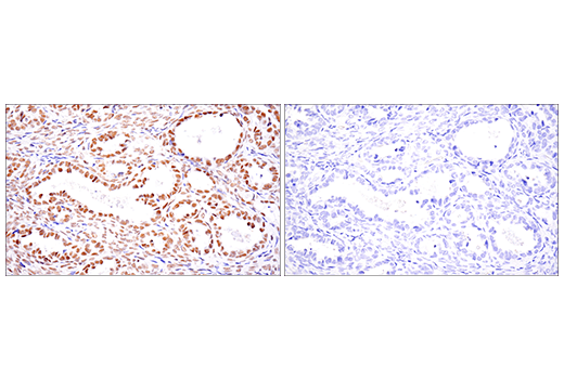 Immunohistochemistry Image 6: SETD2 (E4W8Q) Rabbit mAb (IHC Formulated)