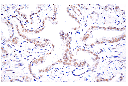 Immunohistochemistry Image 9: SETD2 (E4W8Q) Rabbit mAb (IHC Formulated)