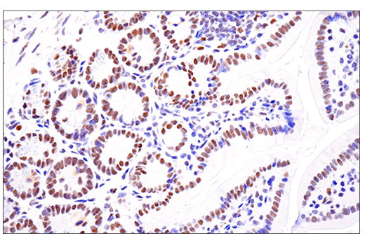 Immunohistochemistry Image 10: SETD2 (E4W8Q) Rabbit mAb (IHC Formulated)