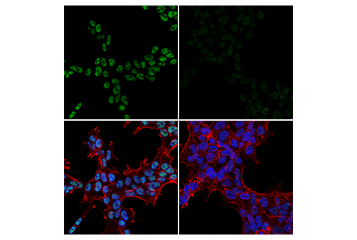 Immunofluorescence Image 1: SETD2 (E4W8Q) Rabbit mAb (IHC Formulated)