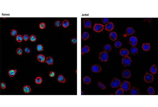 Immunofluorescence Image 1: PAX5 (D19F8) XP® Rabbit mAb