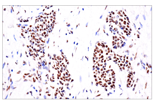 Immunohistochemistry Image 1: TDP43 (E2G6G) Rabbit mAb