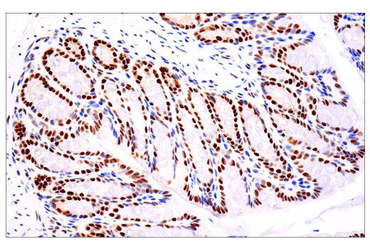 Immunohistochemistry Image 3: TDP43 (E2G6G) Rabbit mAb