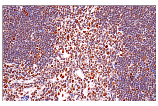 Immunohistochemistry Image 7: TDP43 (E2G6G) Rabbit mAb