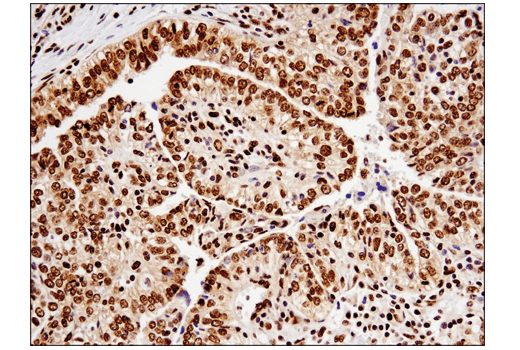 Immunohistochemistry Image 1: TDP43 (D9R3L) Rabbit mAb