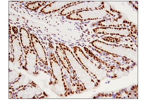 Immunohistochemistry Image 4: TDP43 (D9R3L) Rabbit mAb