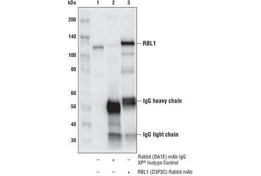Immunoprecipitation Image 1: RBL1 (D3P3C) Rabbit mAb