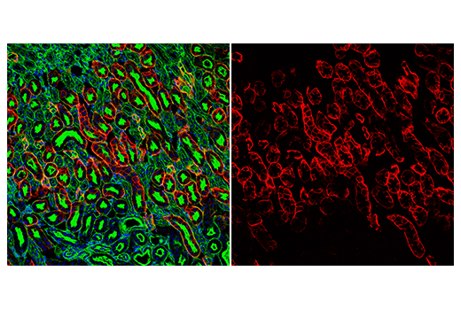 Immunofluorescence Image 3: AQP4 (D1F8E) XP® Rabbit mAb (Alexa Fluor® 647 Conjugate)