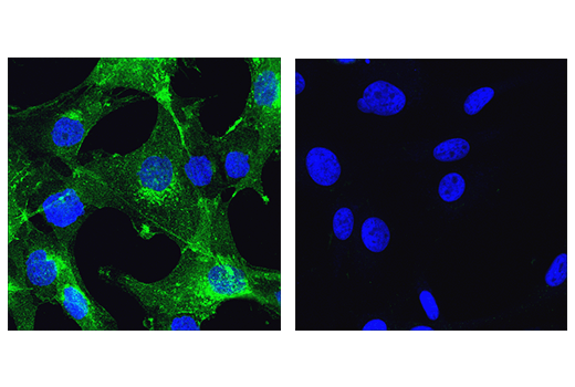 Immunofluorescence Image 1: NCAM-L1 (D5N9S) Rabbit mAb