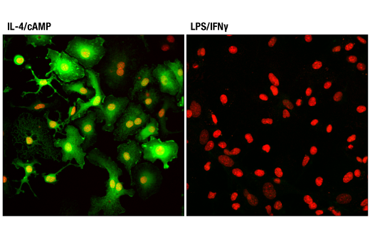Immunofluorescence Image 2: Arginase-1 (D4E3M™) XP® Rabbit mAb (BSA and Azide Free)
